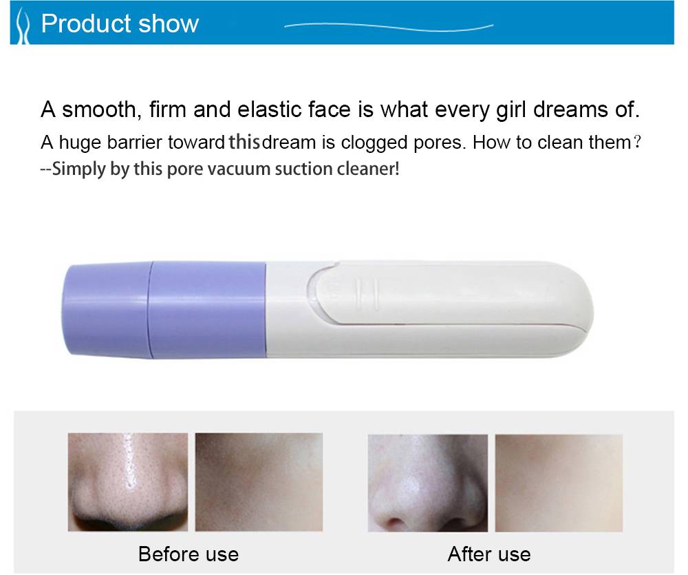 image-describe Handheld Electric Blackhead Remover Cleaner Vacuum Suction Skin Care Nose Mask as picture 1